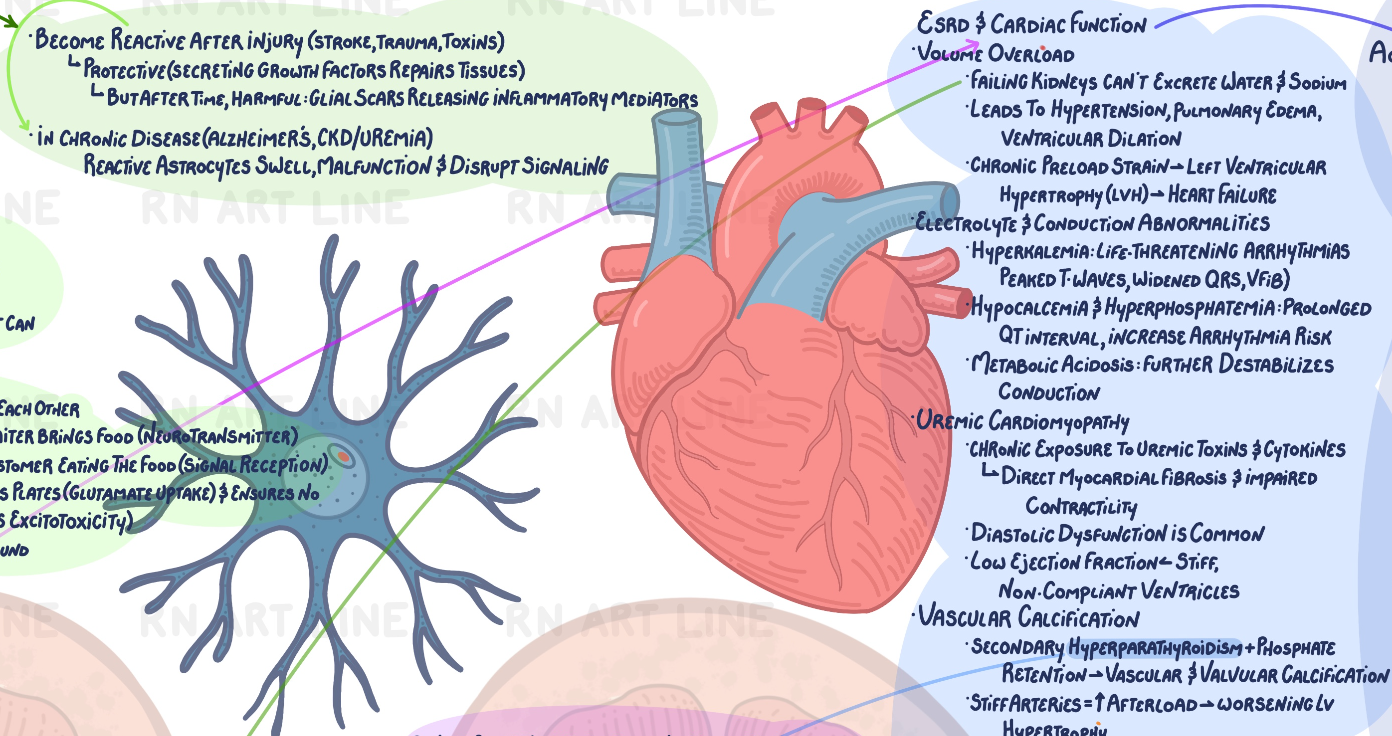 End-Stage Renal Disease Concept Map - Digital Study Edition (Watermarked)