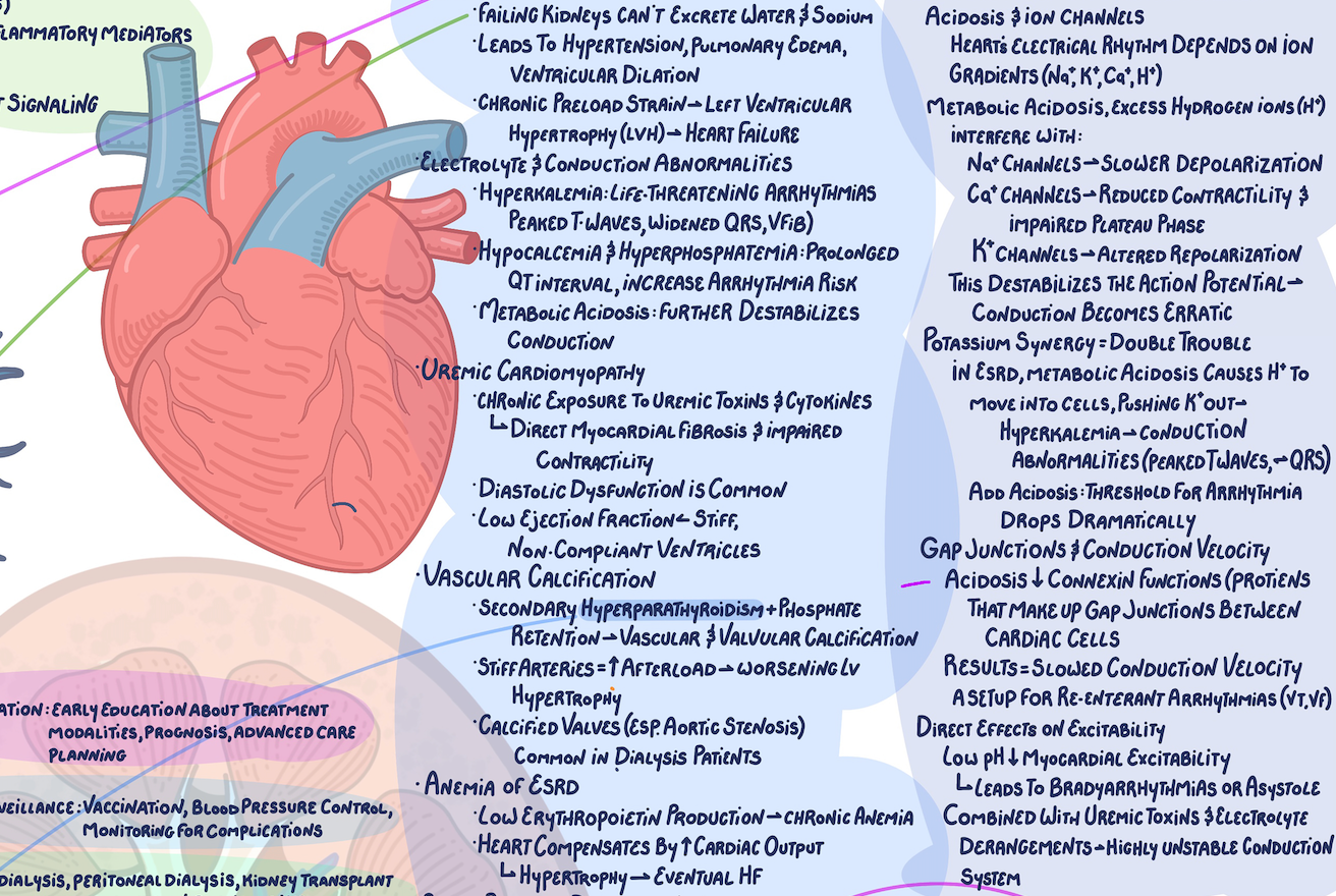 Illustrative Concept Map on End Stage Renal Disease and Chronic Kidney Disease
