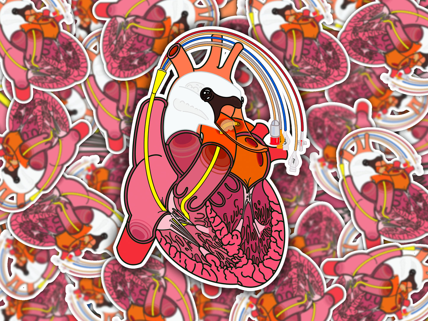 Swan-Ganz Catheter Sticker