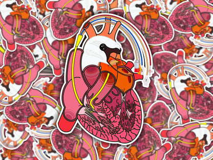 Swan-Ganz Catheter Sticker